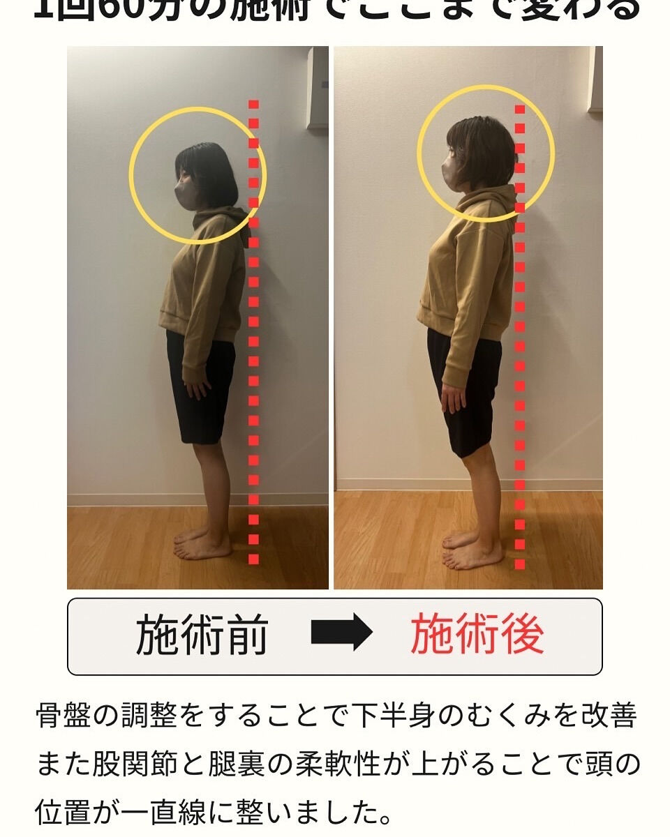 何となくカラダが痛い😣